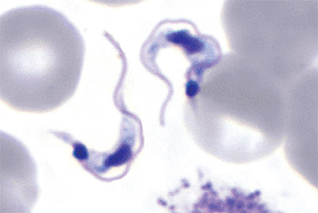 Image: Trypanosoma cruzi in thin blood film (Photo courtesy of US Centers for Disease Control).